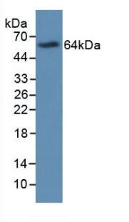 Monoclonal Antibody to Major Basic Protein (MBP)