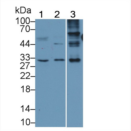 Monoclonal Antibody to Major Basic Protein (MBP)