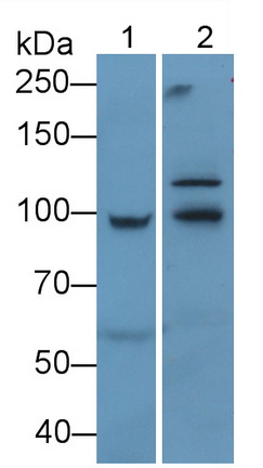 Monoclonal Antibody to Insulin Like Growth Factor 1 Receptor (IGF1R)