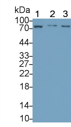 Monoclonal Antibody to Lymphocyte Activation Gene 3 (LAG3)