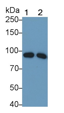Monoclonal Antibody to Complement Component 1, S Subcomponent (C1s)