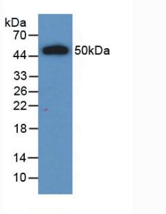 Monoclonal Antibody to Interleukin 28A (IL28A)