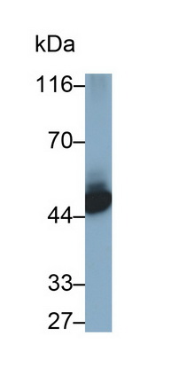 Monoclonal Antibody to Cytokeratin 10 (CK10)