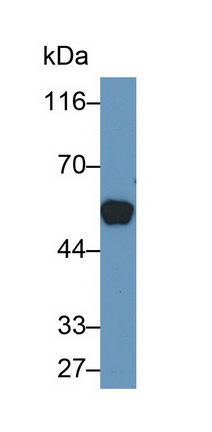 Monoclonal Antibody to Cytokeratin 10 (CK10)