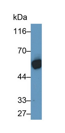 Monoclonal Antibody to Cytokeratin 10 (CK10)