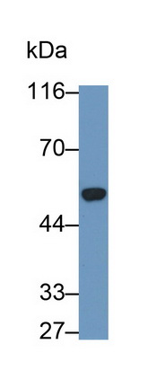 Monoclonal Antibody to Cytokeratin 10 (CK10)