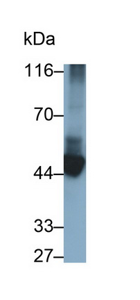 Monoclonal Antibody to Cytokeratin 10 (CK10)