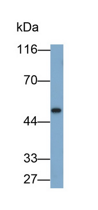 Monoclonal Antibody to Cytokeratin 10 (CK10)