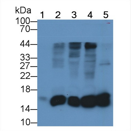 Monoclonal Antibody to Fatty Acid Binding Protein 4 (FABP4)