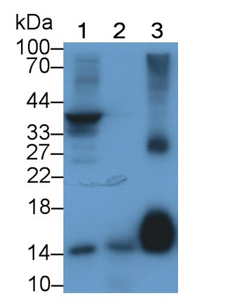 Monoclonal Antibody to Fatty Acid Binding Protein 4 (FABP4)