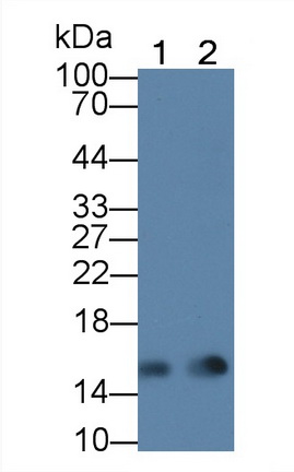 Monoclonal Antibody to Fatty Acid Binding Protein 4 (FABP4)