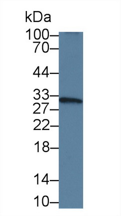 Monoclonal Antibody to Vascular Endothelial Growth Factor 165 (VEGF165)