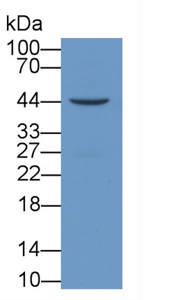 Monoclonal Antibody to Vascular Endothelial Growth Factor 165 (VEGF165)