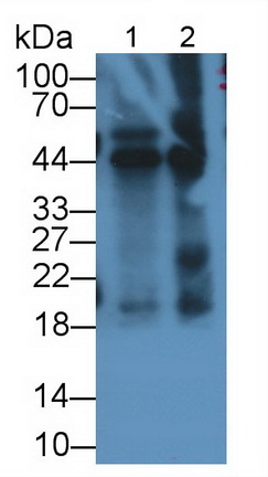 Monoclonal Antibody to Vascular Endothelial Growth Factor 165 (VEGF165)