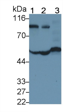 Monoclonal Antibody to Alpha-1-Antitrypsin (a1AT)