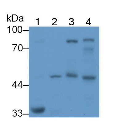 Monoclonal Antibody to Alpha-1-Antitrypsin (a1AT)