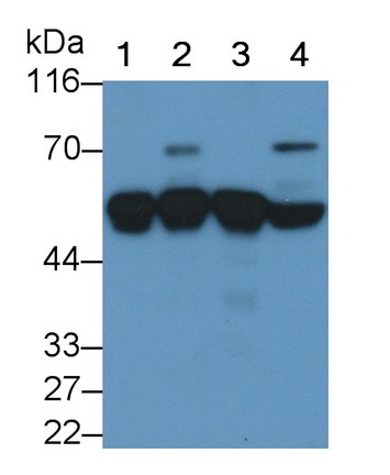 Monoclonal Antibody to Alpha-1-Antitrypsin (a1AT)