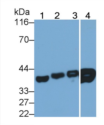 Monoclonal Antibody to Lactate Dehydrogenase B (LDHB)