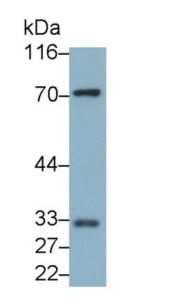 Monoclonal Antibody to Immunoglobulin Superfamily, Member 12 (IGSF12)