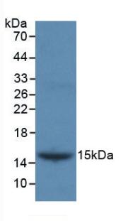 Monoclonal Antibody to Inhibin Beta B (INHbB)