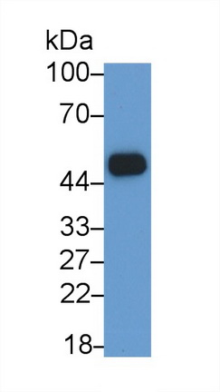 Monoclonal Antibody to Inhibin Beta B (INHbB)