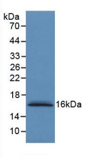 Monoclonal Antibody to S100 Calcium Binding Protein A6 (S100A6)