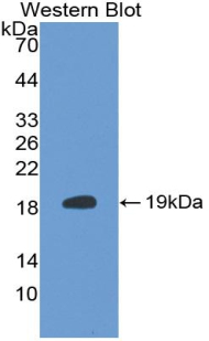 Monoclonal Antibody to S100 Calcium Binding Protein A6 (S100A6)