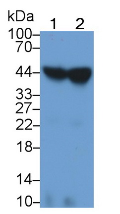 Monoclonal Antibody to Orosomucoid 2 (ORM2)