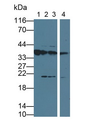 Monoclonal Antibody to Orosomucoid 2 (ORM2)