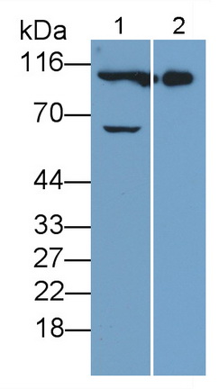 Monoclonal Antibody to Neprilysin (CD10)