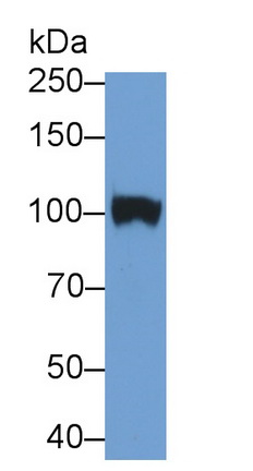 Monoclonal Antibody to Neprilysin (CD10)