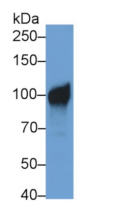 Monoclonal Antibody to Neprilysin (CD10)