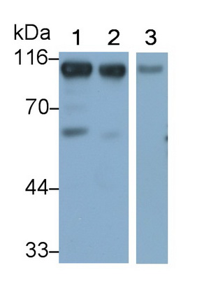 Monoclonal Antibody to Neprilysin (CD10)