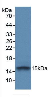 Monoclonal Antibody to Fibroblast Growth Factor Receptor 1 (FGFR1)