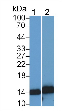 Monoclonal Antibody to S100 Calcium Binding Protein A9 (S100A9)