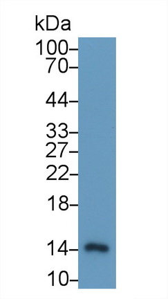 Monoclonal Antibody to S100 Calcium Binding Protein A9 (S100A9)