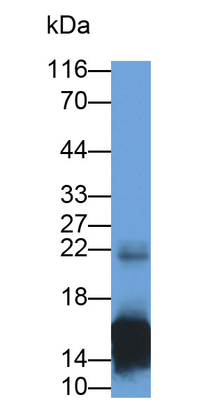 Monoclonal Antibody to S100 Calcium Binding Protein A9 (S100A9)