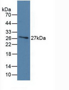 Monoclonal Antibody to Vitamin D Binding Protein (DBP)