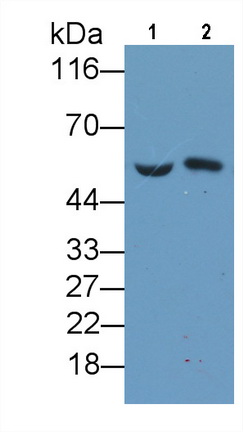 Monoclonal Antibody to Vitamin D Binding Protein (DBP)