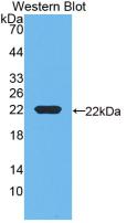 Monoclonal Antibody to Vitamin D Binding Protein (DBP)