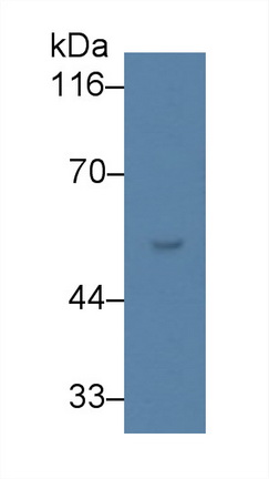 Monoclonal Antibody to Vitamin D Binding Protein (DBP)