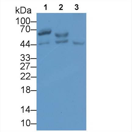 Monoclonal Antibody to Squamous Cell Carcinoma Antigen 1/2 (SCCA1/SCCA2)