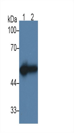 Monoclonal Antibody to Cytokeratin 17 (CK17)