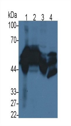 Monoclonal Antibody to Cytokeratin 17 (CK17)