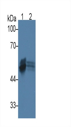 Monoclonal Antibody to Cytokeratin 17 (CK17)