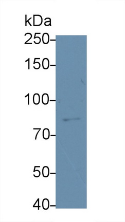 Monoclonal Antibody to Transglutaminase 2 (TGM2)