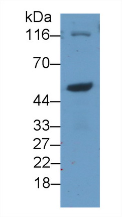 Monoclonal Antibody to Hedgehog Homolog, Sonic (SHH)