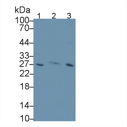 Monoclonal Antibody to Complement Factor D (CFD)