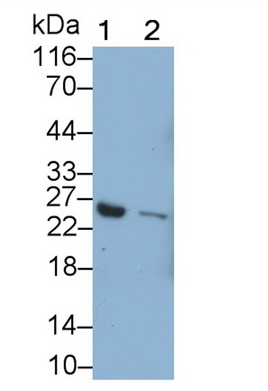 Monoclonal Antibody to Complement Factor D (CFD)