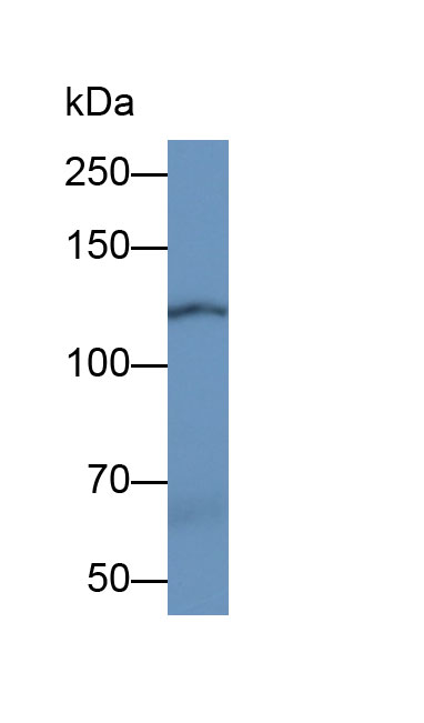 Monoclonal Antibody to Vinculin (VCL)